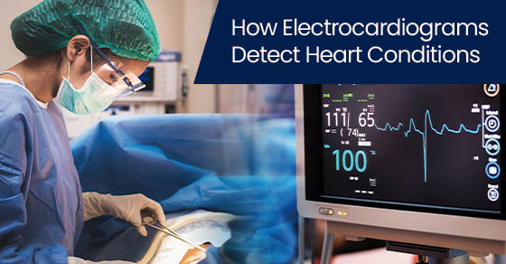 How electrocardiograms detect heart conditions
